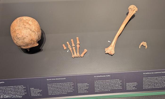 menschliche Überreste aus einem Massengrab des Bauernkriegs 